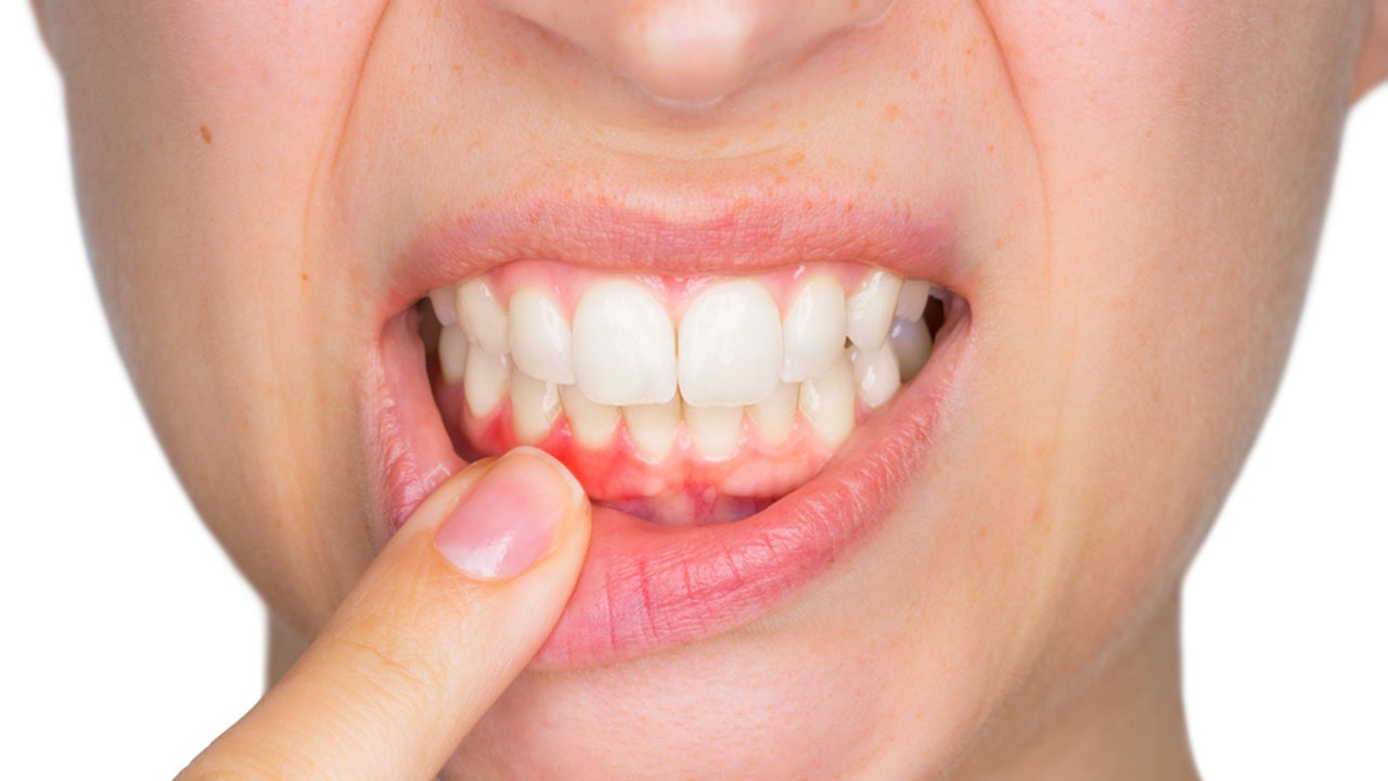 Ağız ve diş sağlığını nasıl koruyabiliriz?