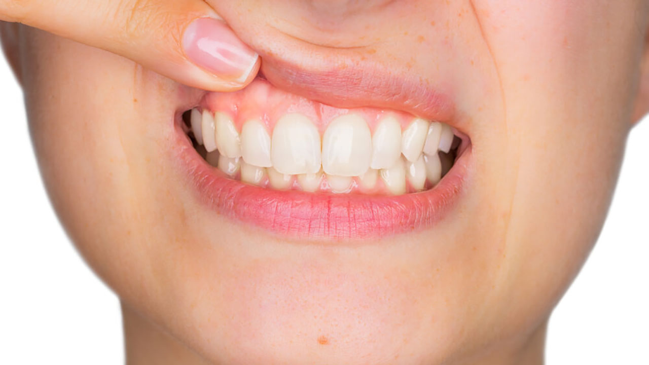 Sağlıklı diş ve diş etleri için neler yapmalı?